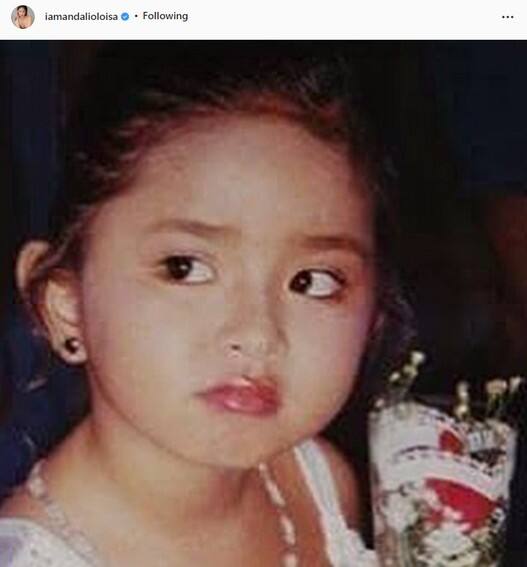 Throwback photos of Kapamilya actresses