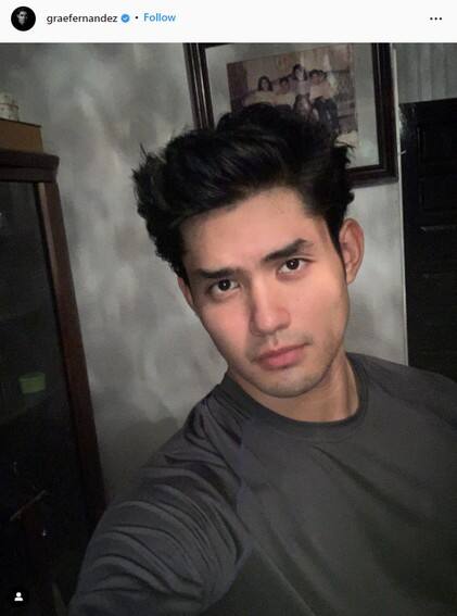 LOOK: These Kapamilya stars had major transformations for a teleserye role