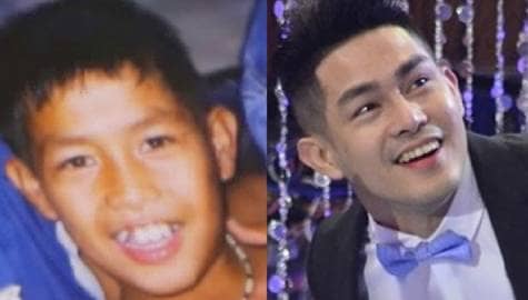 Ion Perez Then and Now Photos | ABS-CBN Entertainment