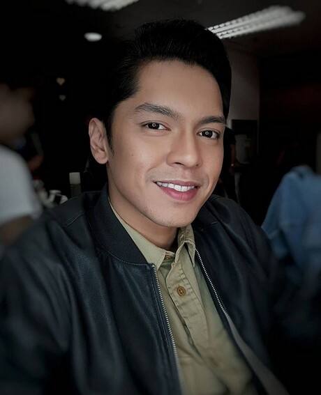 carlo aquino throwback photos