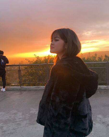 Janine Berdin’s glow-up transformation in 48 photos