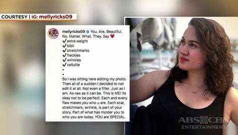Melissa Ricks, may payo sa mga nanay na nahihiya sa kanilang ‘Imperfections’ Image Thumbnail